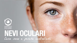 nevi-oculari-ponticello-eye-clinic-massa-carrara